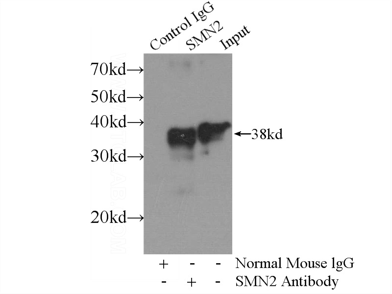 IP Result of anti-SMN2 (IP:Catalog No:107594, 4ug; Detection:Catalog No:107594 1:500) with HEK-293 cells lysate 2440ug.
