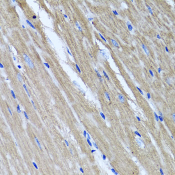 Immunohistochemistry - TNFAIP6 Polyclonal Antibody 