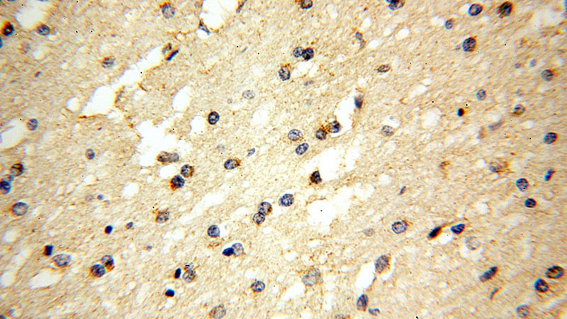 Immunohistochemical of paraffin-embedded human brain using Catalog No:112527(MFF antibody) at dilution of 1:100 (under 40x lens)