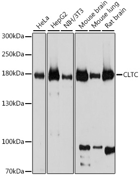 Western blot - CLTC Polyclonal Antibody 