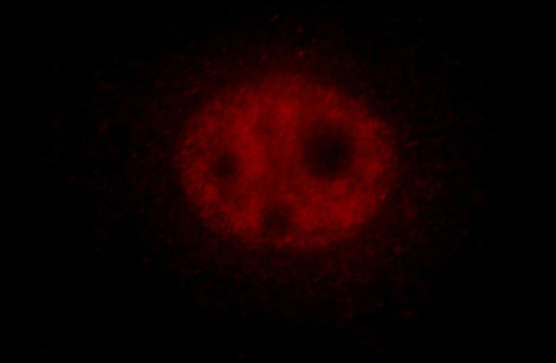 Immunofluorescent analysis of Hela cells, using SF3B5 antibody Catalog No:115140 at 1:25 dilution and Rhodamine-labeled goat anti-rabbit IgG (red).