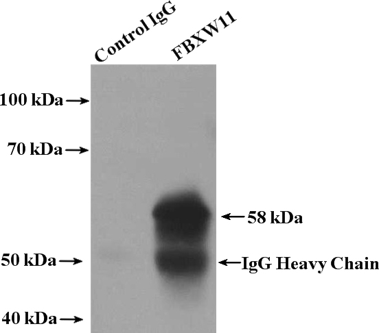 IP Result of anti-FBXW11 (IP:Catalog No:110561, 4ug; Detection:Catalog No:110561 1:600) with mouse stomach tissue lysate 4000ug.