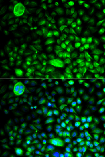 Immunofluorescence - CACNG2 Polyclonal Antibody 