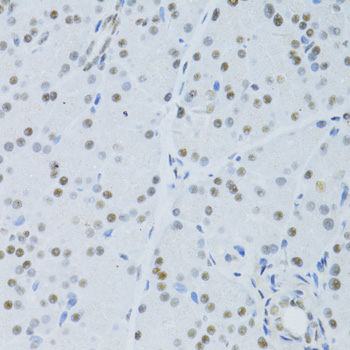 Immunohistochemistry - SNRNP70 Polyclonal Antibody 