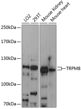 Western blot - TRPM8 Polyclonal Antibody 