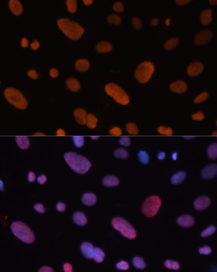 Immunohistochemistry - HDGF Polyclonal Antibody 