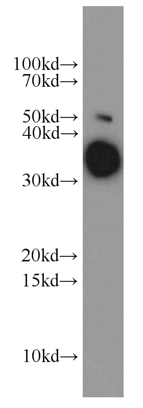 mouse liver tissue were subjected to SDS PAGE followed by western blot with Catalog No:112248(ARG1 antibody) at dilution of 1:1000
