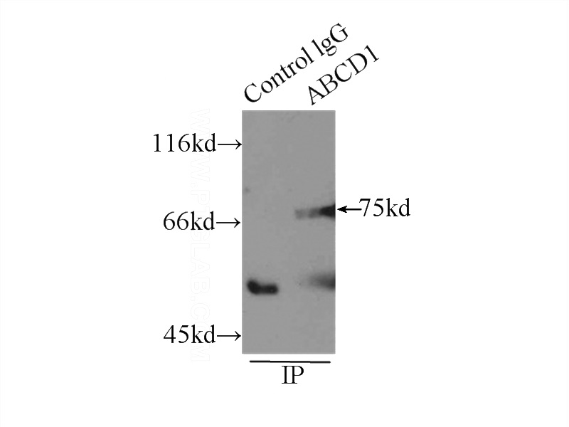 IP Result of anti-ABCD1 (IP:Catalog No:107801, 4ug; Detection:Catalog No:107801 1:500) with mouse liver tissue lysate 5000ug.