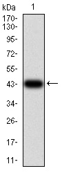 Fig1: Western blot analysis of IL1RAPL1 on human IL1RAPL1 recombinant protein using anti-IL1RAPL1 antibody at 1/1,000 dilution.