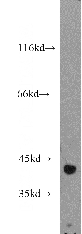 human skeletal muscle tissue were subjected to SDS PAGE followed by western blot with Catalog No:111605(IDH3A antibody) at dilution of 1:1200