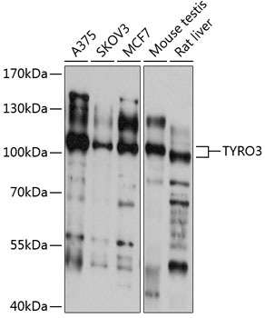 Western blot - TYRO3 Polyclonal Antibody 
