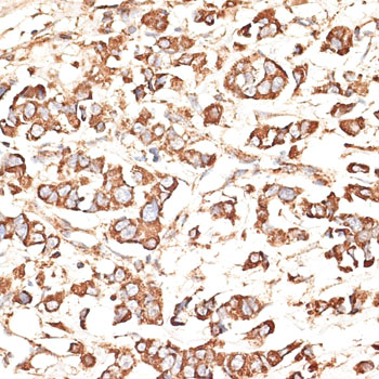 Immunohistochemistry - KIR3DS1 Polyclonal Antibody 