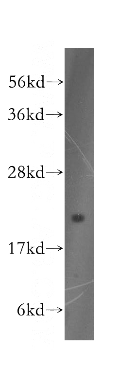 HEK-293 cells were subjected to SDS PAGE followed by western blot with Catalog No:110120(DUSP22 antibody) at dilution of 1:400