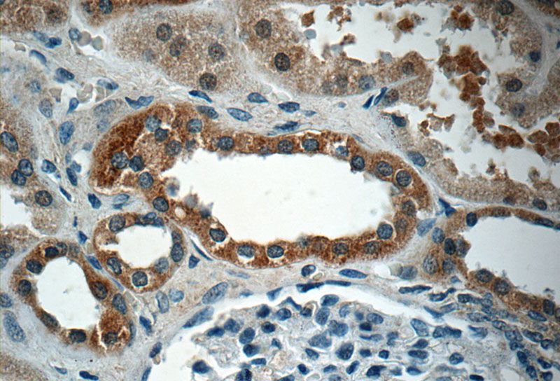 Immunohistochemistry of paraffin-embedded human kidney tissue slide using Catalog No:110390(EPO Antibody) at dilution of 1:50 (under 40x lens)