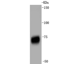 Fig1:; Western blot analysis of p75 NGF Receptor on skeletal muscle tissue lysates. Proteins were transferred to a PVDF membrane and blocked with 5% BSA in PBS for 1 hour at room temperature. The primary antibody ( 1/500) was used in 5% BSA at room temperature for 2 hours. Goat Anti-Rabbit IgG - HRP Secondary Antibody (HA1001) at 1:5,000 dilution was used for 1 hour at room temperature.
