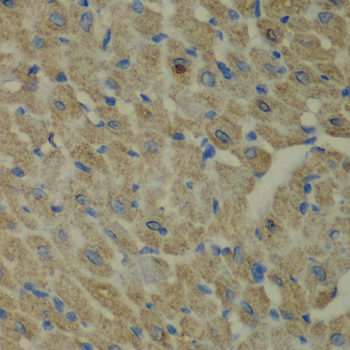 Immunohistochemistry - CCBL1 Polyclonal Antibody 
