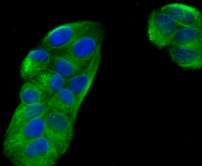 Fig3:; ICC staining of Ephrin B2 in Hela cells (green). Formalin fixed cells were permeabilized with 0.1% Triton X-100 in TBS for 10 minutes at room temperature and blocked with 10% negative goat serum for 15 minutes at room temperature. Cells were probed with the primary antibody ( 1/50) for 1 hour at room temperature, washed with PBS. Alexa Fluor®488 conjugate-Goat anti-Rabbit IgG was used as the secondary antibody at 1/1,000 dilution. The nuclear counter stain is DAPI (blue).