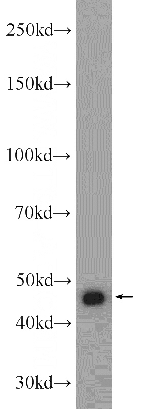 mouse brain tissue were subjected to SDS PAGE followed by western blot with Catalog No:111170(GSK3B Antibody) at dilution of 1:1000