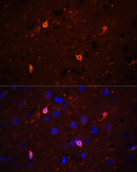 Immunofluorescence - CORO1A Polyclonal Antibody 