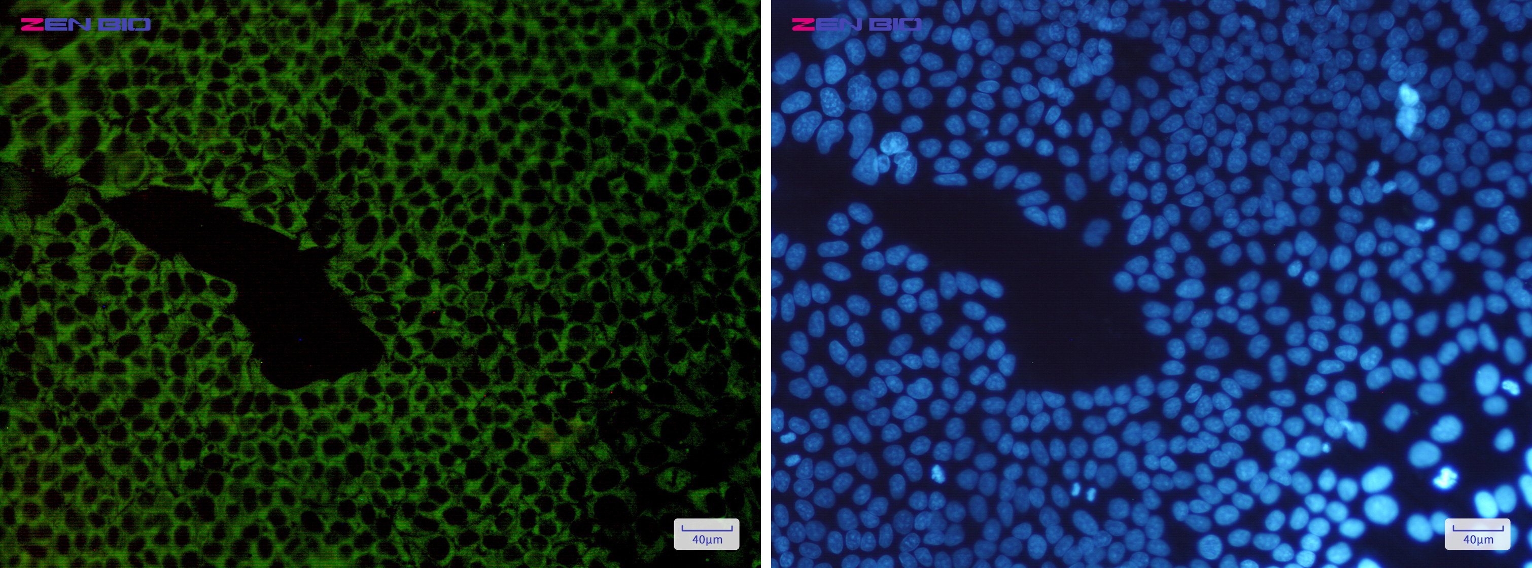 Immunocytochemistry of G3BP(green) in Hela cells using G3BP Rabbit mAb at dilution 1/200, and DAPI(blue)