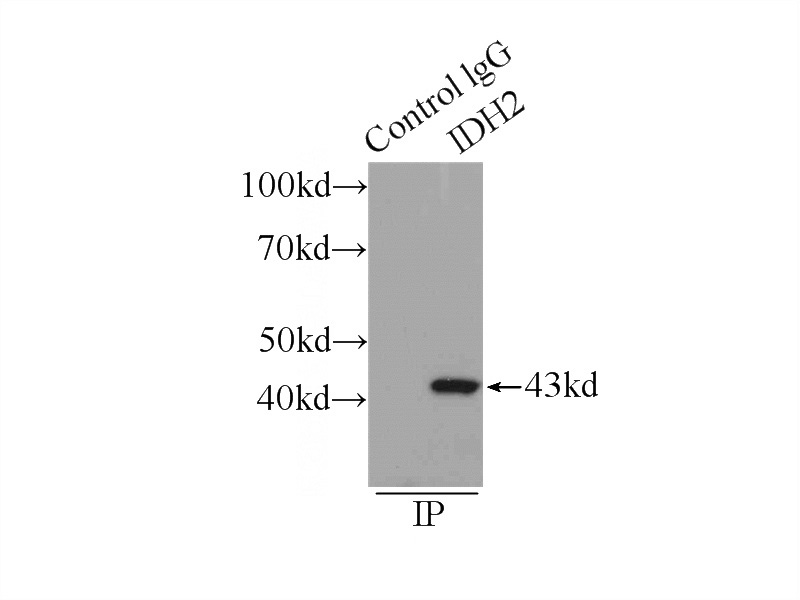 IP Result of anti-IDH2 (IP:Catalog No:111604, 3ug; Detection:Catalog No:111604 1:1000) with mouse brain tissue lysate 6000ug.