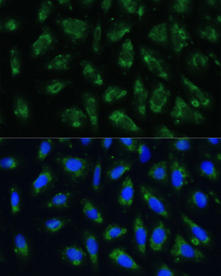 Immunofluorescence - APOB Polyclonal Antibody 