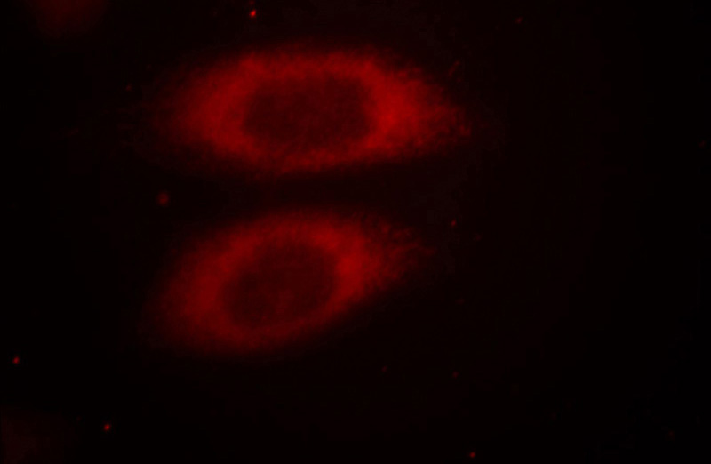 Immunofluorescent analysis of Hela cells, using JTV1 antibody Catalog No:111898 at 1:25 dilution and Rhodamine-labeled goat anti-rabbit IgG (red).