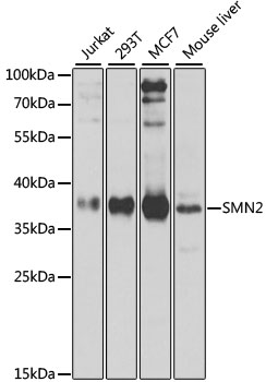 Western blot - SMN2 Polyclonal Antibody 