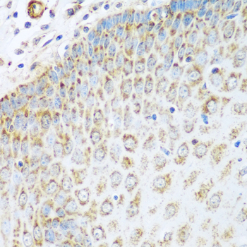 Immunohistochemistry - GLUD1 Polyclonal Antibody 