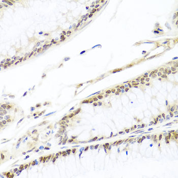 Immunohistochemistry - HIRA Polyclonal Antibody 