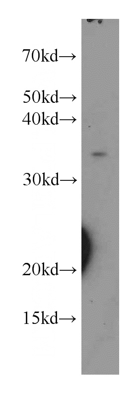 human stomach tissue were subjected to SDS PAGE followed by western blot with Catalog No:112031(KDSR antibody) at dilution of 1:800