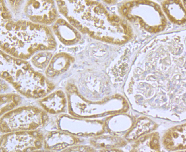 Fig5: Immunohistochemical analysis of paraffin-embedded human uterus tissue using anti-CACNA1C antibody. Counter stained with hematoxylin.