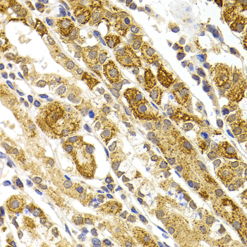 Immunohistochemistry - BMP15 Polyclonal Antibody 