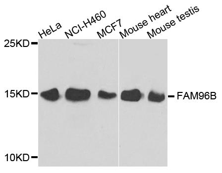 Western blot - FAM96B Polyclonal Antibody 