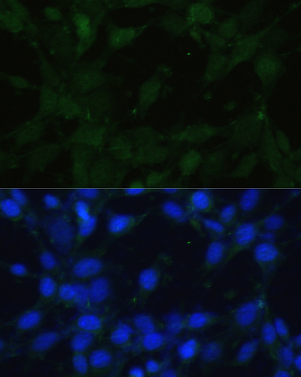 Immunofluorescence - TRPV1 Polyclonal Antibody 
