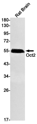 Western blot detection of 44106 in Rat Brain lysates using Oct2 Rabbit mAb(1:1000 diluted).Predicted band size:51kDa.Observed band size:55kDa.