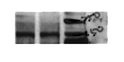 WB result of anti-COL4A5 (Catalog No:109382) with rat aorta.