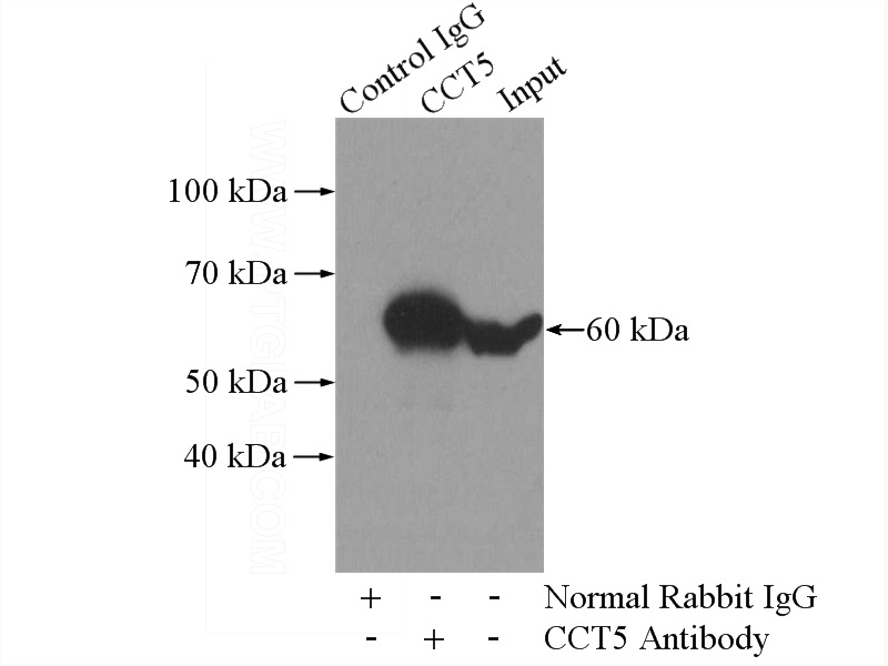 IP Result of anti-CCT5 (IP:Catalog No:109084, 4ug; Detection:Catalog No:109084 1:1000) with HeLa cells lysate 1200ug.