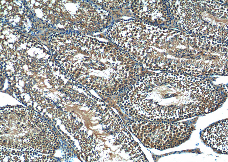 Immunohistochemistry of paraffin-embedded mouse testis tissue slide using Catalog No:108621(C19orf36 Antibody) at dilution of 1:50 (under 10x lens)
