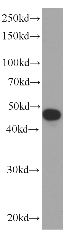 Jurkat cells were subjected to SDS PAGE followed by western blot with Catalog No:107133(CD38 Antibody) at dilution of 1:1000