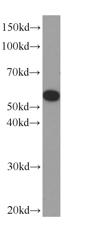 L02 cells were subjected to SDS PAGE followed by western blot with Catalog No:107557(TUBA1A(ace-40Lys) Antibody) at dilution of 1:1000