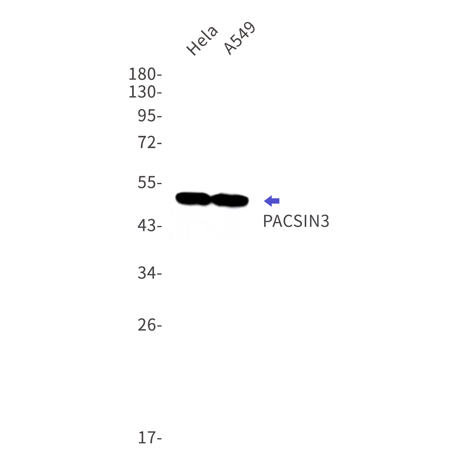 Western blot detection of PACSIN3 in Hela,A549 cell lysates using PACSIN3 Rabbit mAb(1:1000 diluted).Predicted band size:49kDa.Observed band size:49kDa.