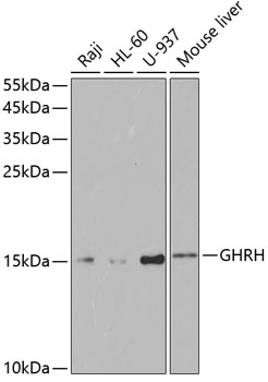 Western blot - GHRH Polyclonal Antibody 