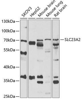 Western blot - SLC23A2 Polyclonal Antibody 