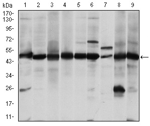 Western blot analysis using ASS1 mouse mAb against A431 (1), RAJI (2), L1210 (3), MOLT4 (4), Jurkat (5), A549 (6), NIH/3T3 (7), PC-12 (8) and Cos7 (9) cell lysate.
