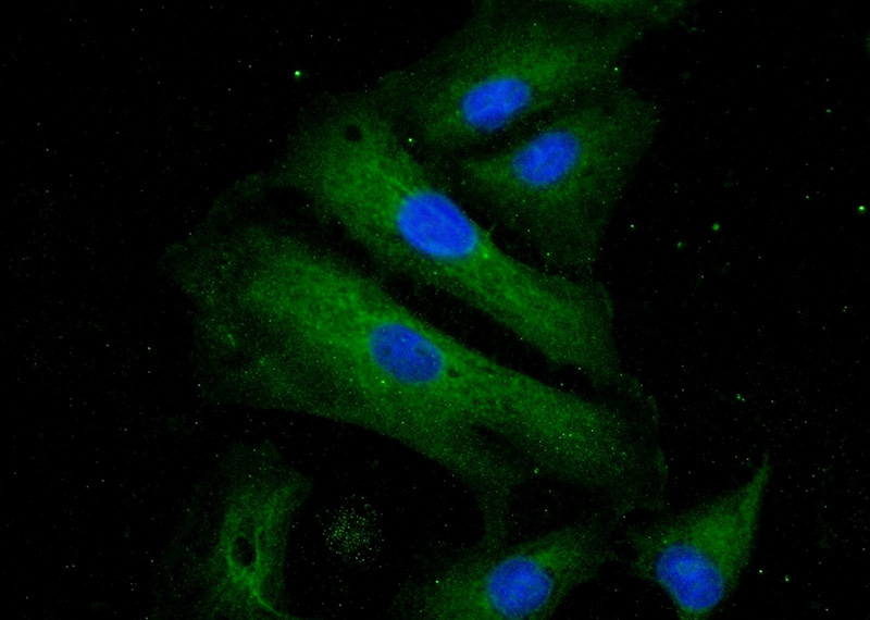 Immunofluorescent analysis of (-20oc Ethanol) fixed A549 cells using Catalog No:116583(USHBP1 Antibody) at dilution of 1:25 and Alexa Fluor 488-congugated AffiniPure Goat Anti-Rabbit IgG(H+L)
