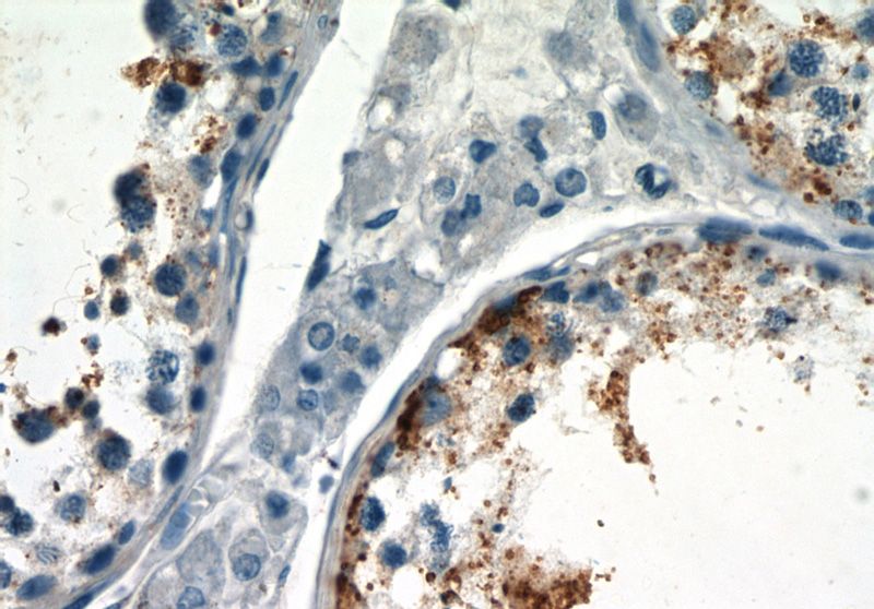 Immunohistochemistry of paraffin-embedded human testis slide using Catalog No:116660(Ubiquilin 3 Antibody) at dilution of 1:50