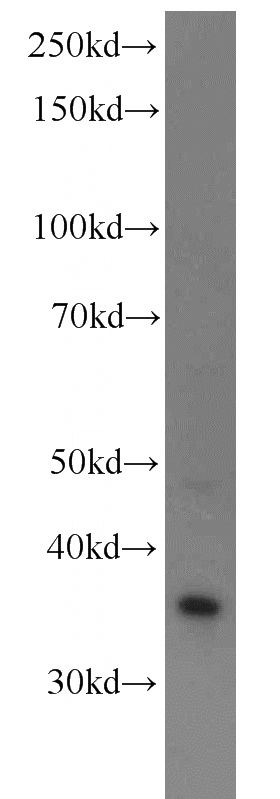 HeLa cells were subjected to SDS PAGE followed by western blot with Catalog No:112644(MAP2K3 antibody) at dilution of 1:1000