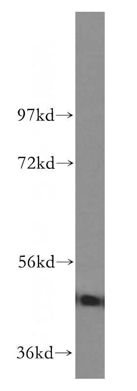 HeLa cells were subjected to SDS PAGE followed by western blot with Catalog No:111171(GSK3B antibody) at dilution of 1:1000