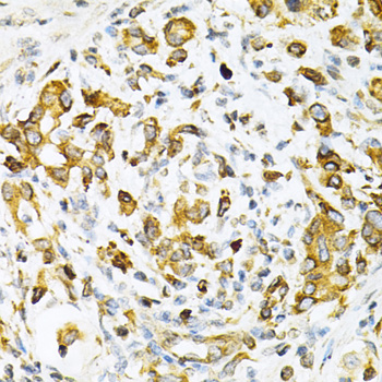 Immunohistochemistry - TAPBP Polyclonal Antibody 